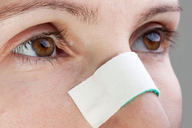 possibili complicazioni nel periodo postoperatorio di correzione del setto nasale