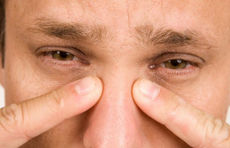 Il dolore persistente al naso è una grave complicanza della rinoplastica